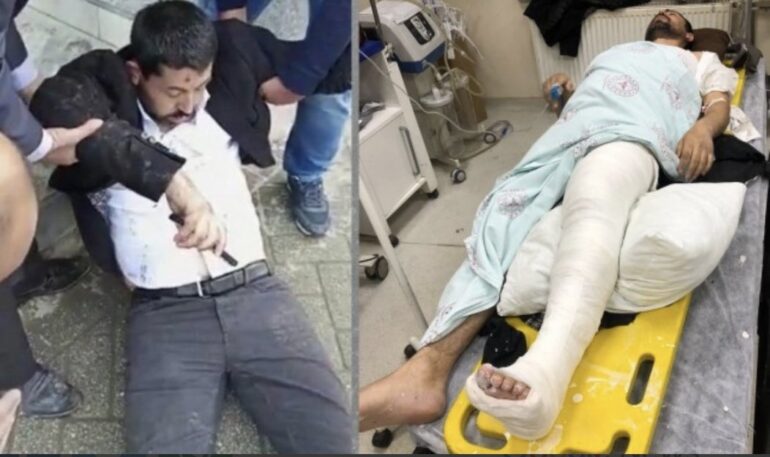 Systematic police attacks by Erdogan regime on HDP deputies